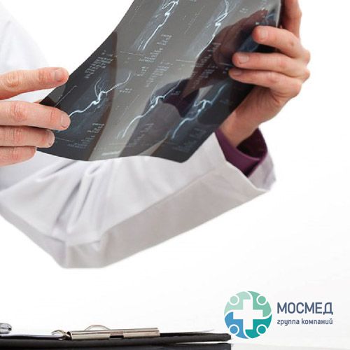 Палата неврологического отделения клиники Мосмед